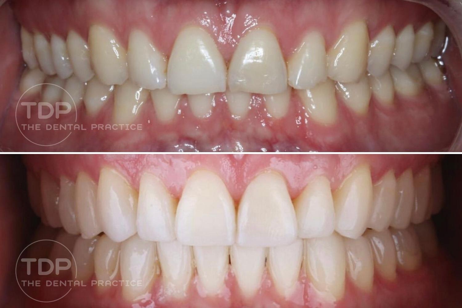 Cosmetic Before & After - the dental practice (1)