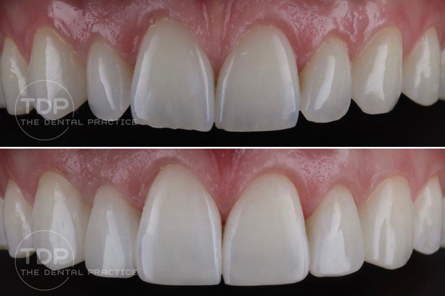 Cosmetic Before & After - the dental practice (2)