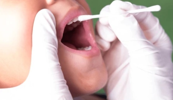 fluoride