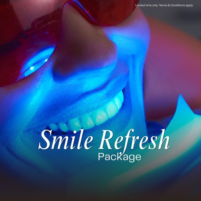 Smile Refresh Package offer at The Dental Practice Burwood