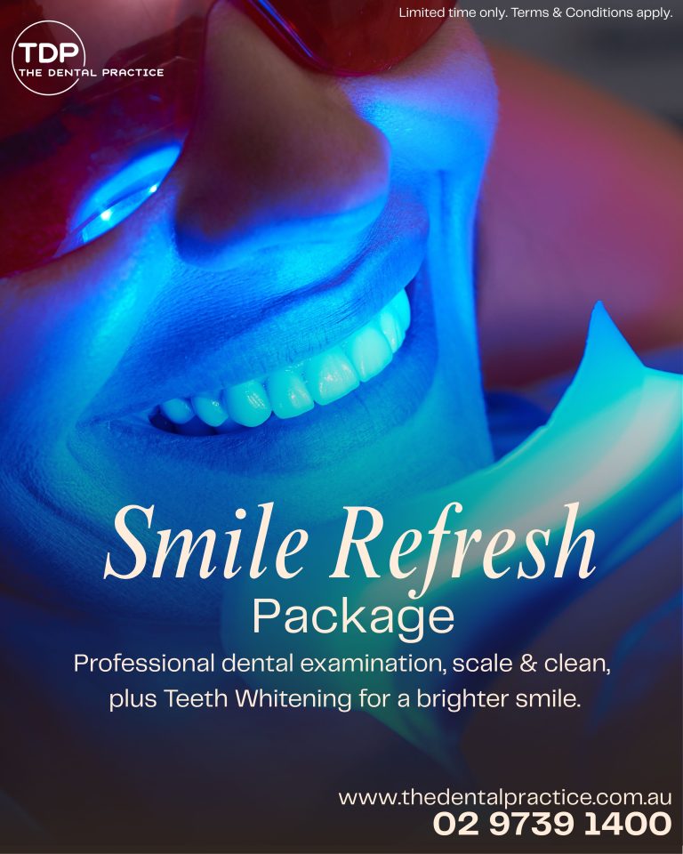 Close-up of a professional whitening treatment in progress